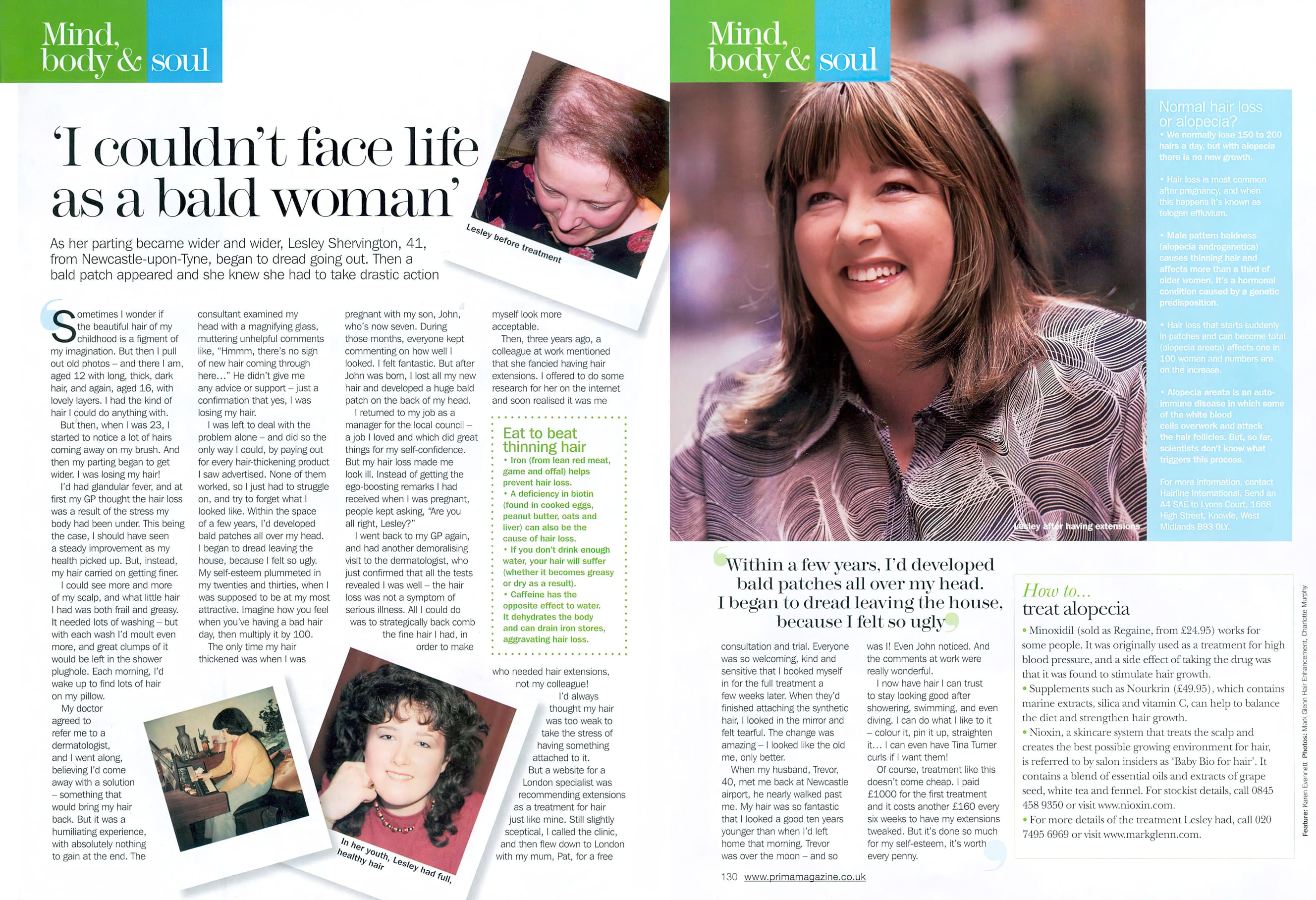 'I couldn't face life as a bald woman' - Alopecia - Mark Glenn's life-changing solution in Prima Magazine