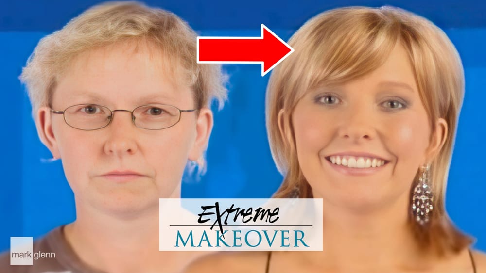 Thinning Hair Sorted - Extreme Makeover UK TV