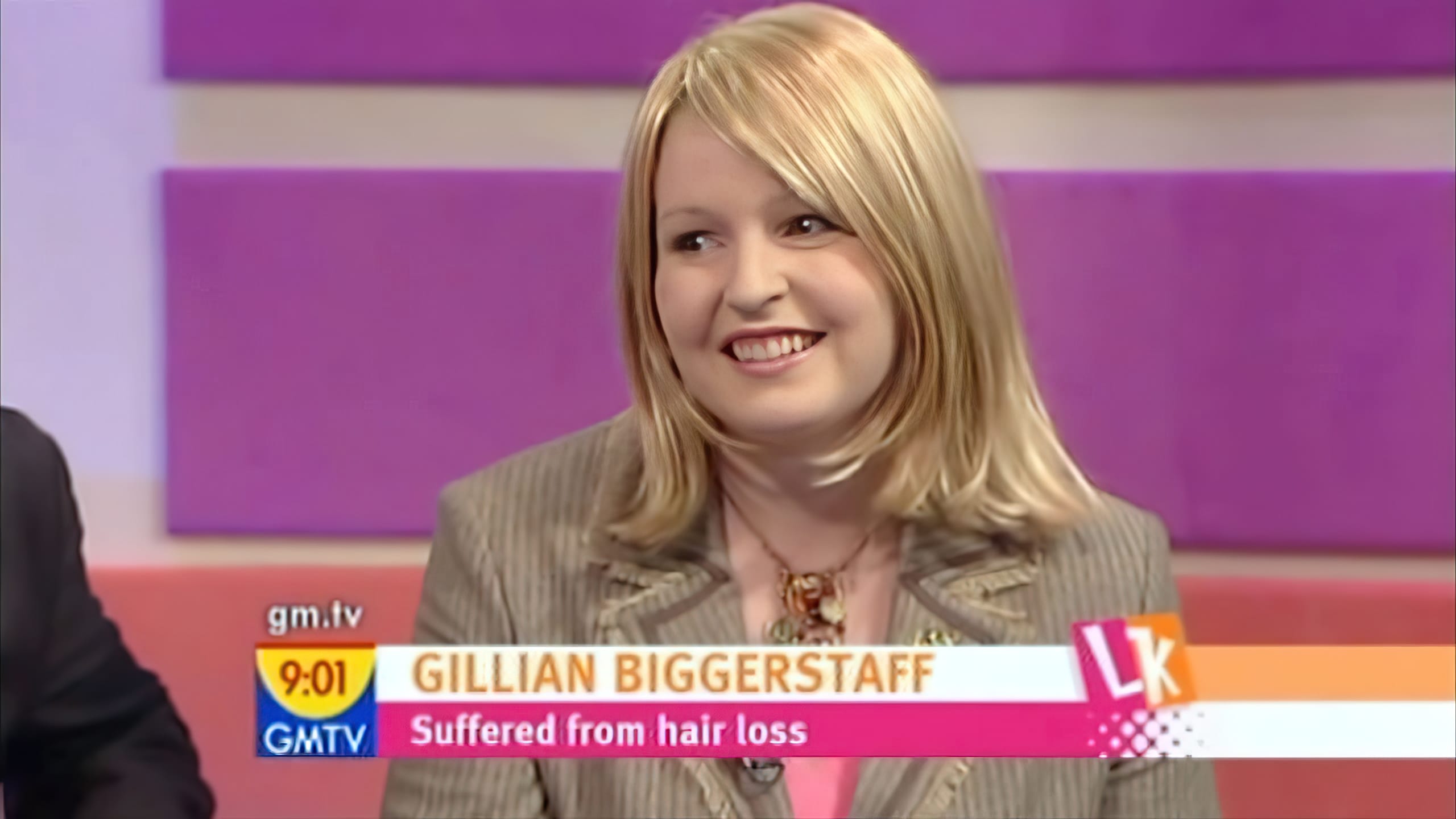 GMTV - Mark Glenn Hair Enhancement Makeover: Day 1