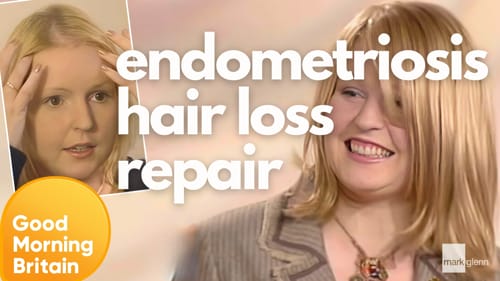 Endometriosis Hair Loss Makeover, LK Today UK TV - Day 2