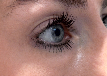 A photo of a person receiving Eyes treatment.