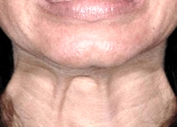 A photo of a person receiving Neck treatment.