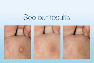 See our results
