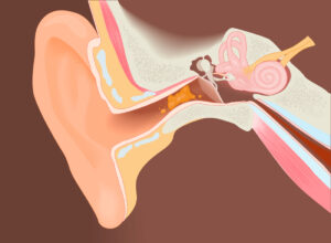 Why is Excessive Ear Wax A Problem