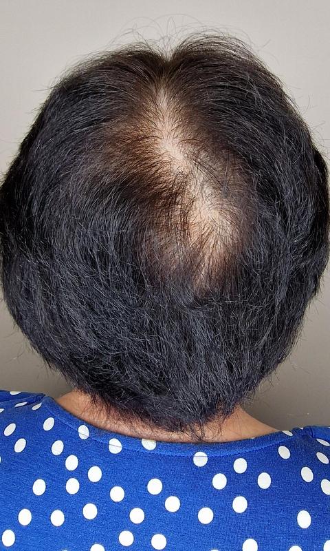 Before Image