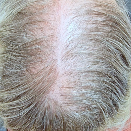 Before Image