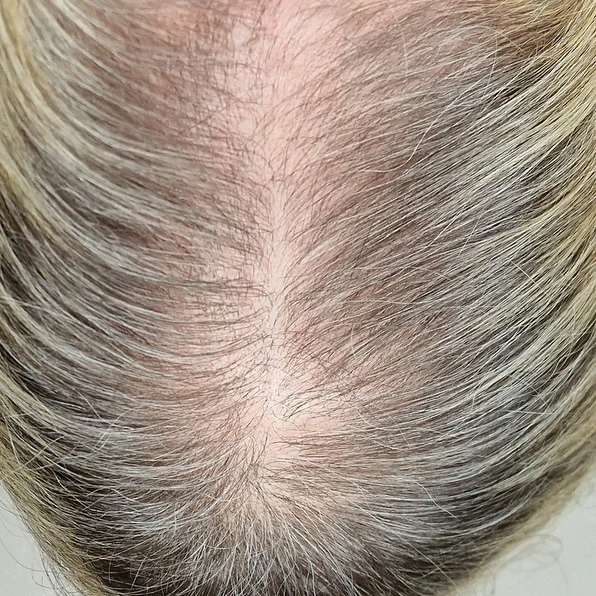 After Image