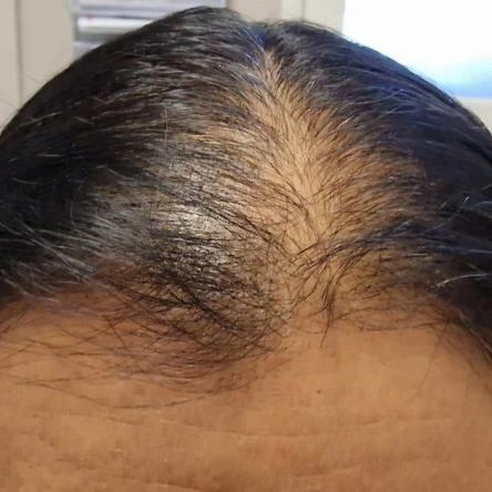 Before Image