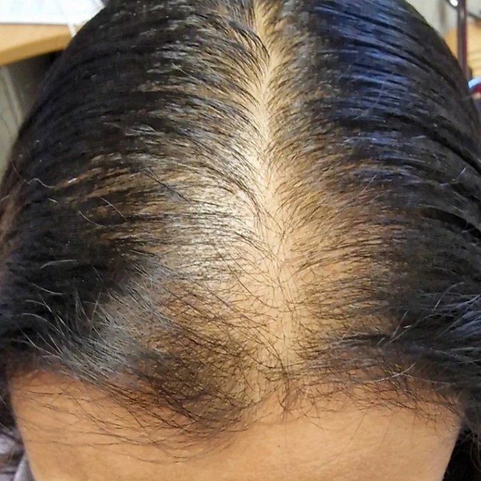 Before Image