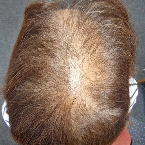 Before Image