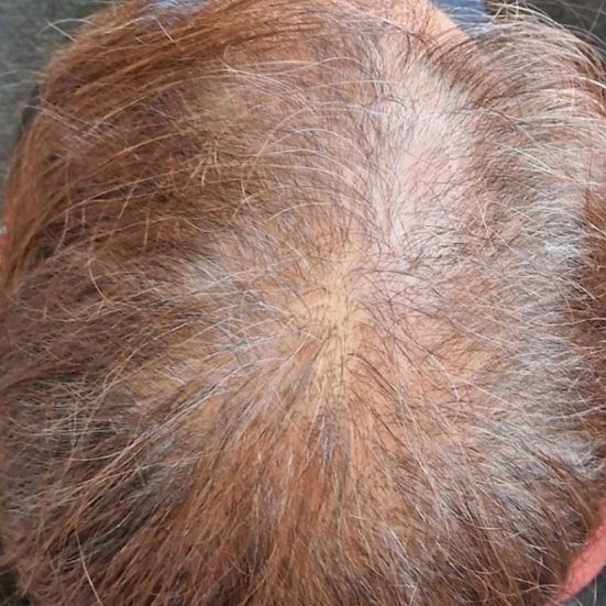 After Image
