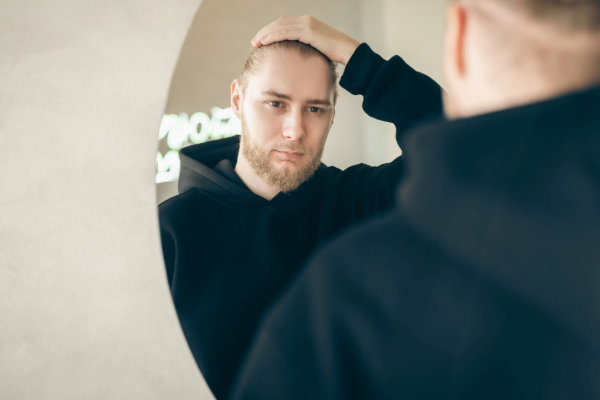 male hair loss